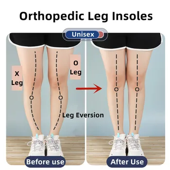 Силиконови ортопедични стелки за краката O/X Корекция вальгусно-варусной деформация подошвенного фасциита Гел стелки Магнитен масаж за грижа за краката